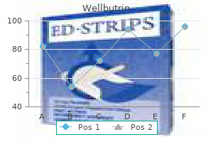 best wellbutrin 300 mg