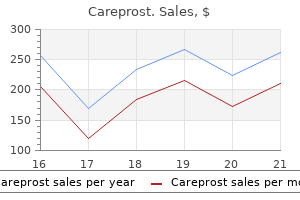 buy careprost with amex