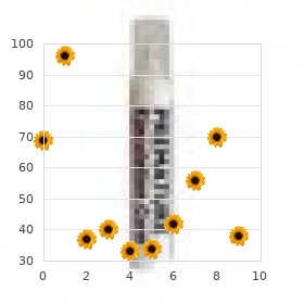 Chromosome 1, monosomy 1q32 q42