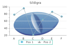 buy sildigra 25mg low price