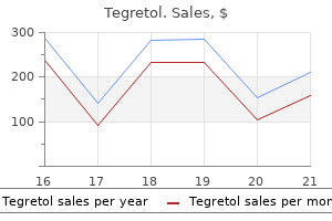 cheap tegretol 200mg on-line