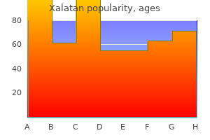 xalatan 2.5 ml free shipping