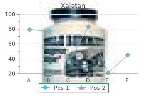 xalatan 2.5 ml mastercard