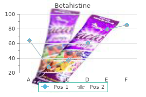 purchase betahistine toronto