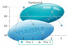 cheap 50 mg fertomid otc