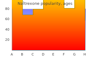 purchase 50 mg naltrexone otc