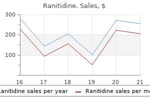 150 mg ranitidine with visa